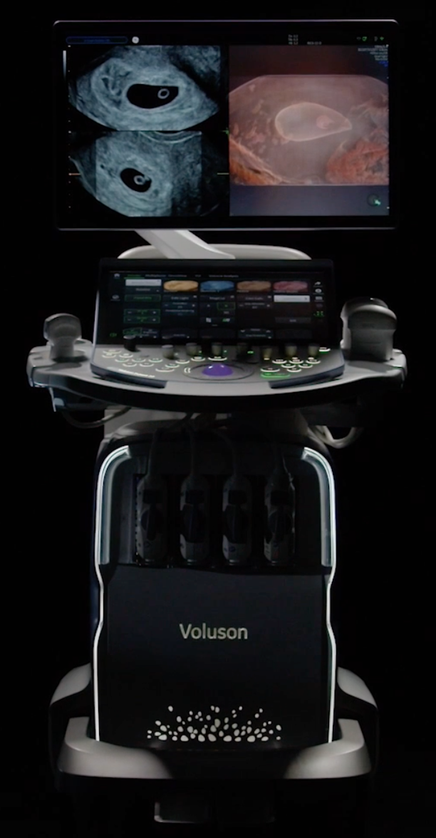 GE HealthCare to Acquire AI Ultrasound Business