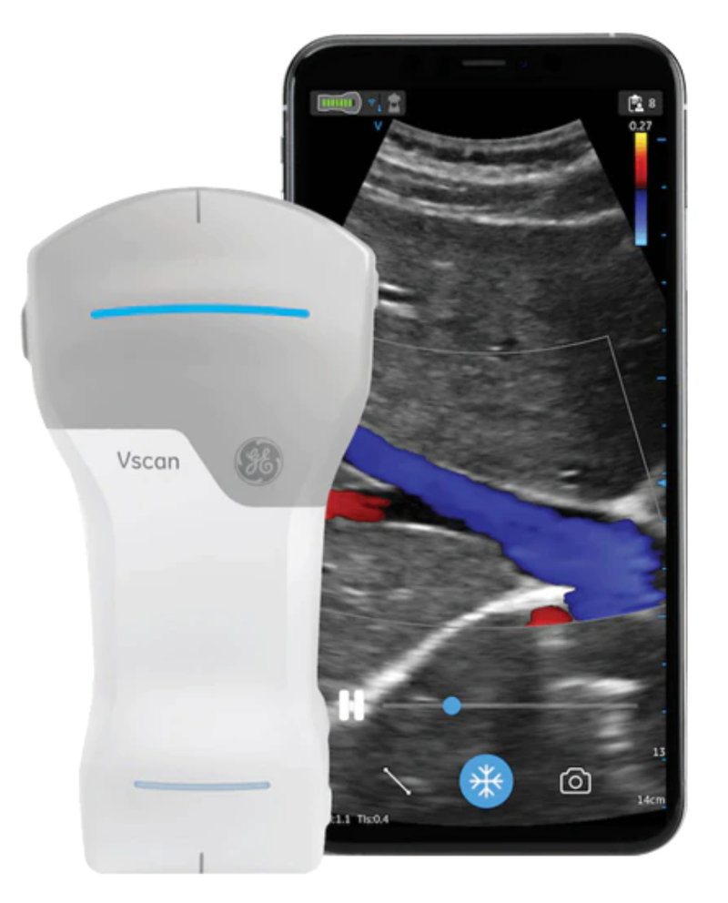 GE Acquires Provider of AI-Powered Image Guidance for Ultrasound
