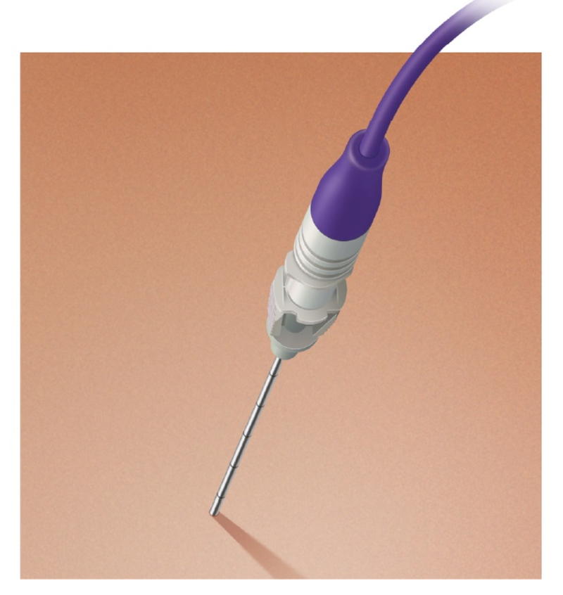 Data Show Promise for Interventional Oncology Treatment of Solid Tumors