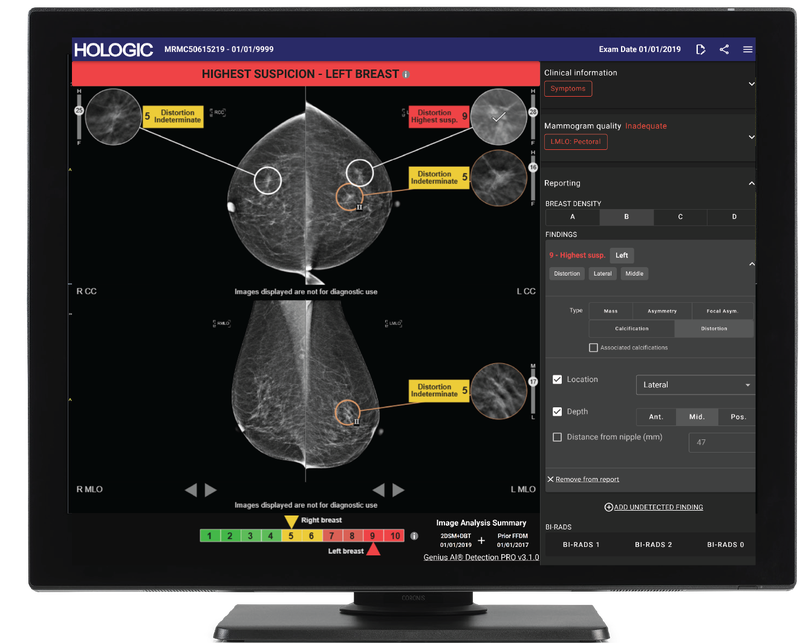 Hologic Showcases Next-Generation AI and Breast Imaging Innovations