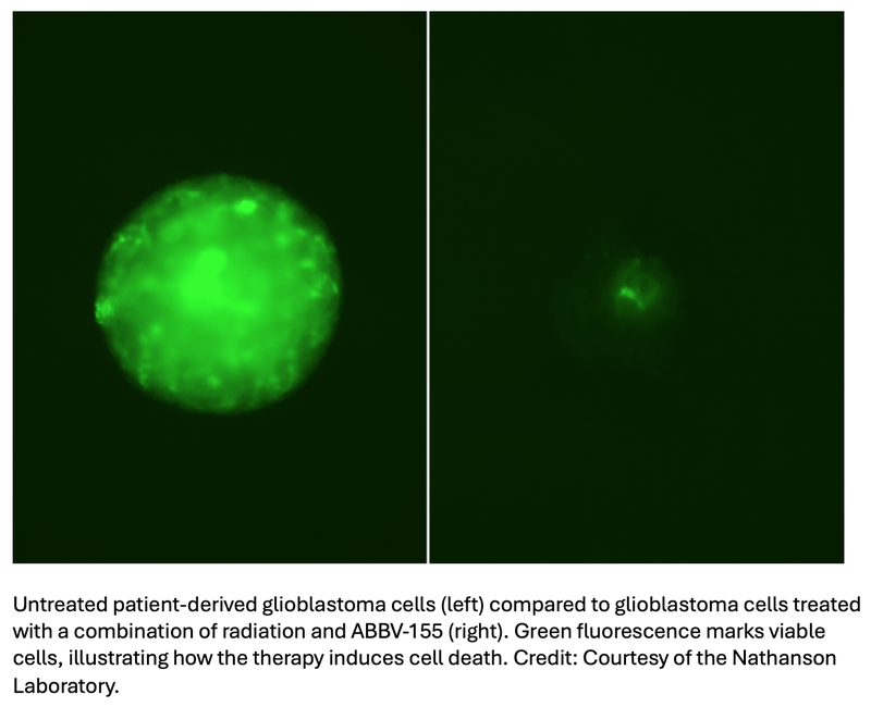 Study Reveals New Approach to Personalized Treatment for Glioblastoma