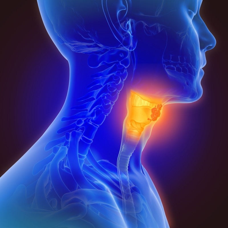 Adding Immunotherapy Shows Benefit in Advanced HPV-Negative Head and Neck Cancers