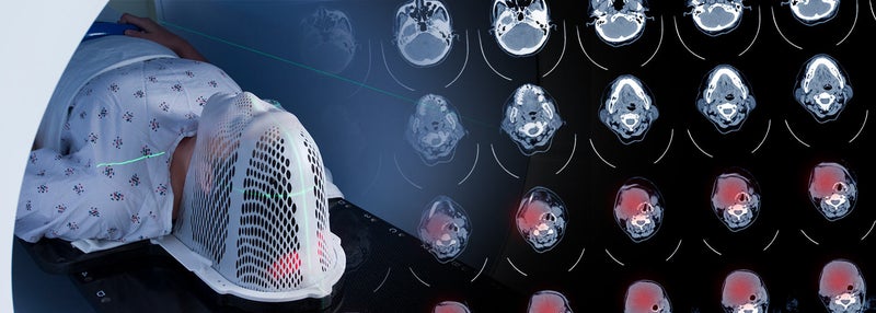 Radiomic Biomarkers from Pre-Treatment CT Scans Could Improve Prognosis, Treatment for Head and Neck Cancers