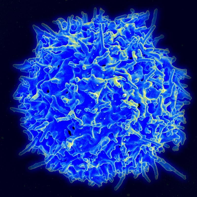 FDA Gives A Nod To "Paradigm Shifting" Cancer Treatment