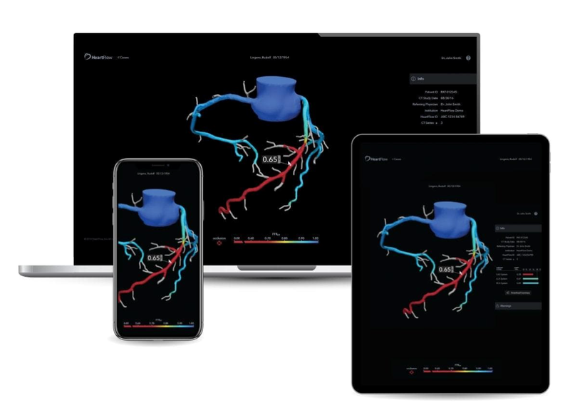 HeartFlow Files for FDA Clearance of Anatomic and Plaque Assessment Tools used in CTA