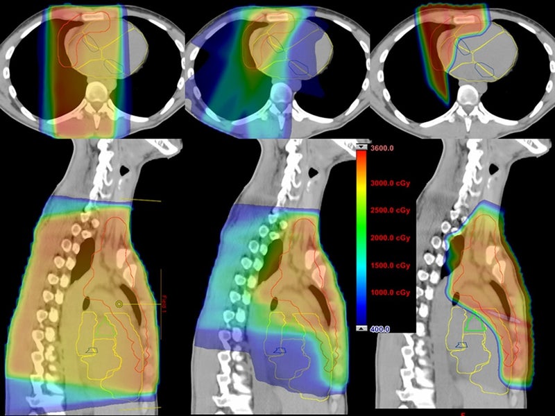 Immunotherapy Boosts Survival of Advanced Hodgkin Lymphoma