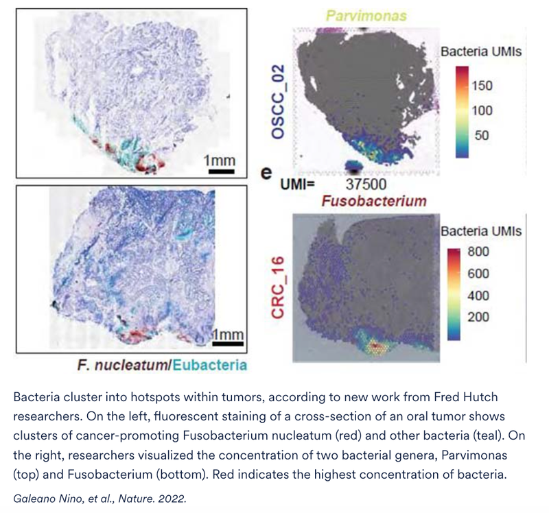 Bacteria May Promote Cancer Cell Growth