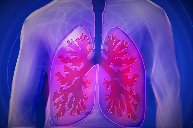 LUNGevity, ASTRO to Offer Lung Cancer Research Grant
