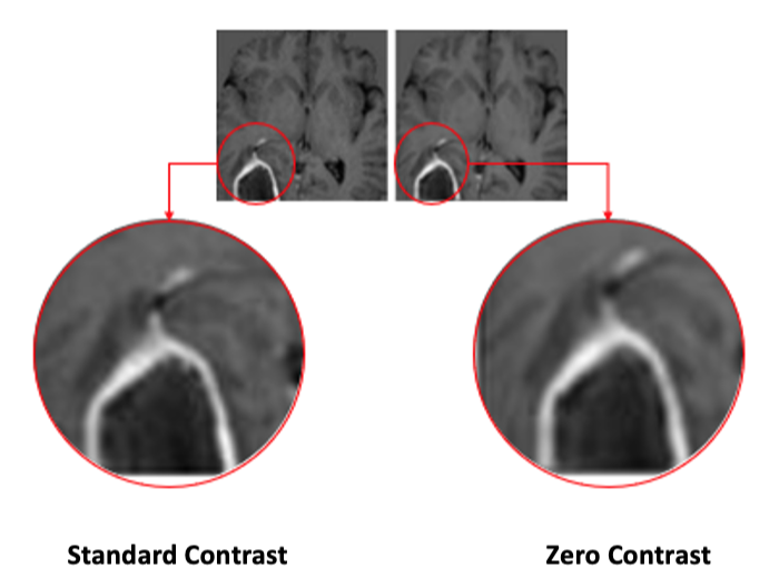 Patent Awarded to Imaging Biometrics for No-Contrast MRI Exams