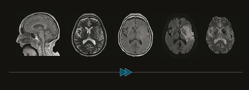 Guerbet, Bracco to Collaborate on Next Generation MRI Contrast