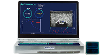 FDA clears Sonavex EchoSure portable ultrasound