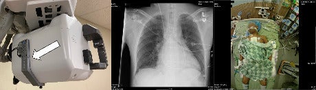 Benefits of adding patient photos to portable chest and abdomen radiographs