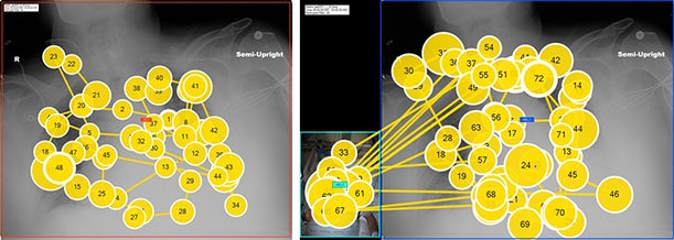 Patient photos do not impede exam interpretation productivity