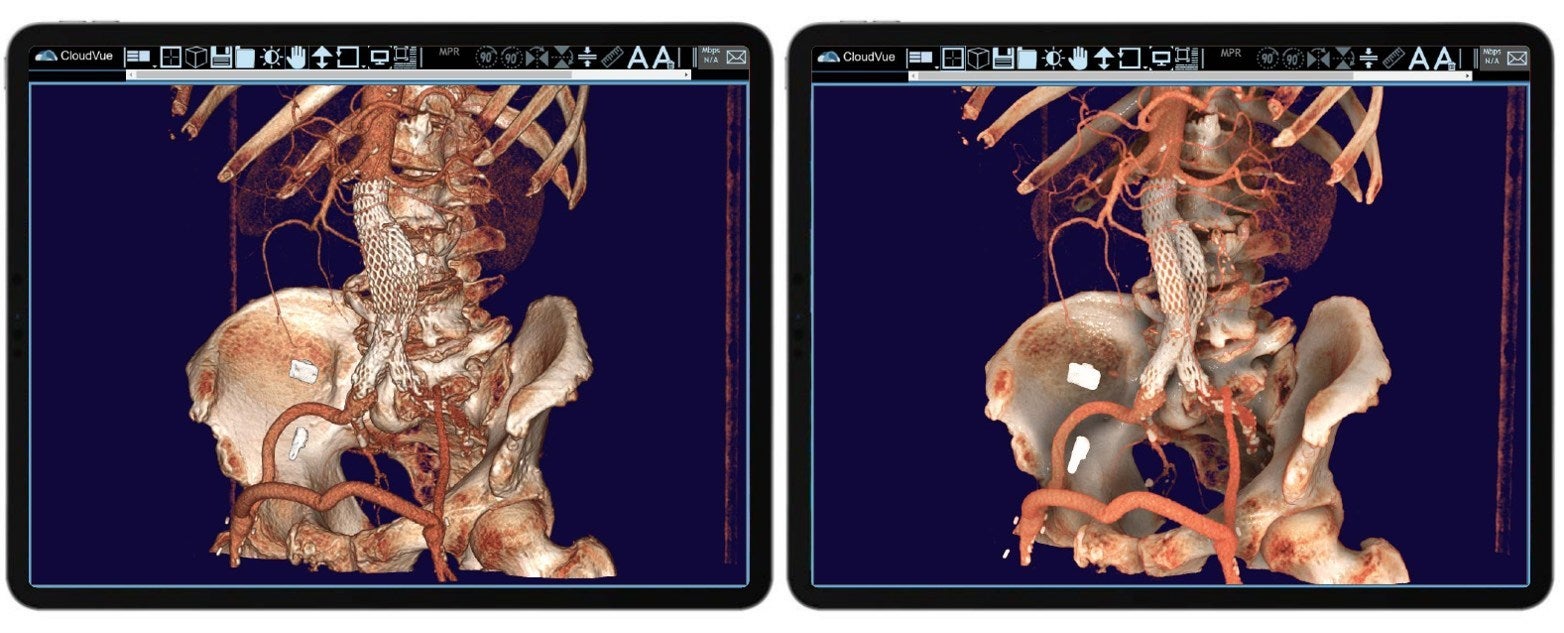 Mobile Cinematic 3D Solution Received FDA Clearance