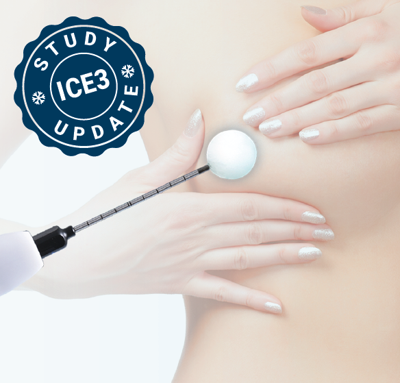 Study Shows Breast Cryoablation a Promising Alternative To Surgery