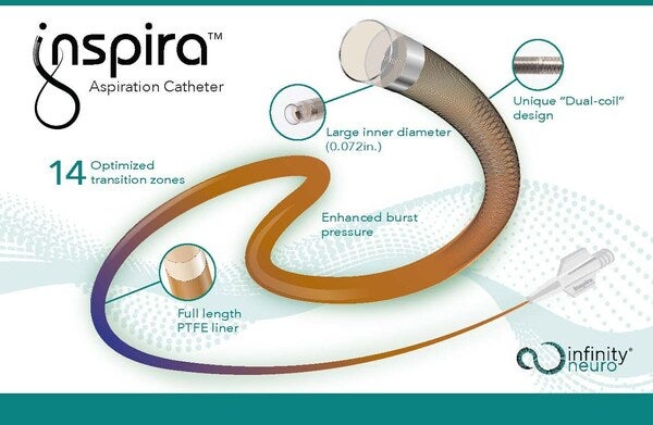 Device to Treat Stroke Gets CE Marking