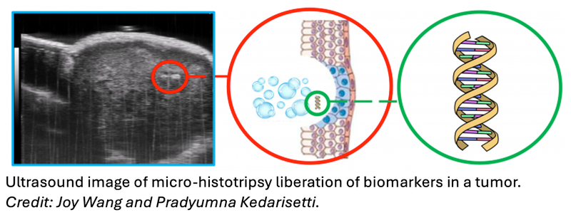 Intense Ultrasound Extracts Genetic Information for Less Invasive Cancer Biopsies