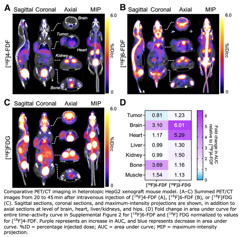 New PET Radiotracer Maps Fructose Metabolism to Detect Diseases