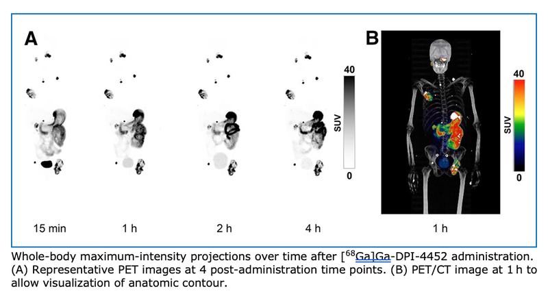 PET Agent Provides Same Day Imaging for Clear Cell Renal Cell Carcinoma Patients