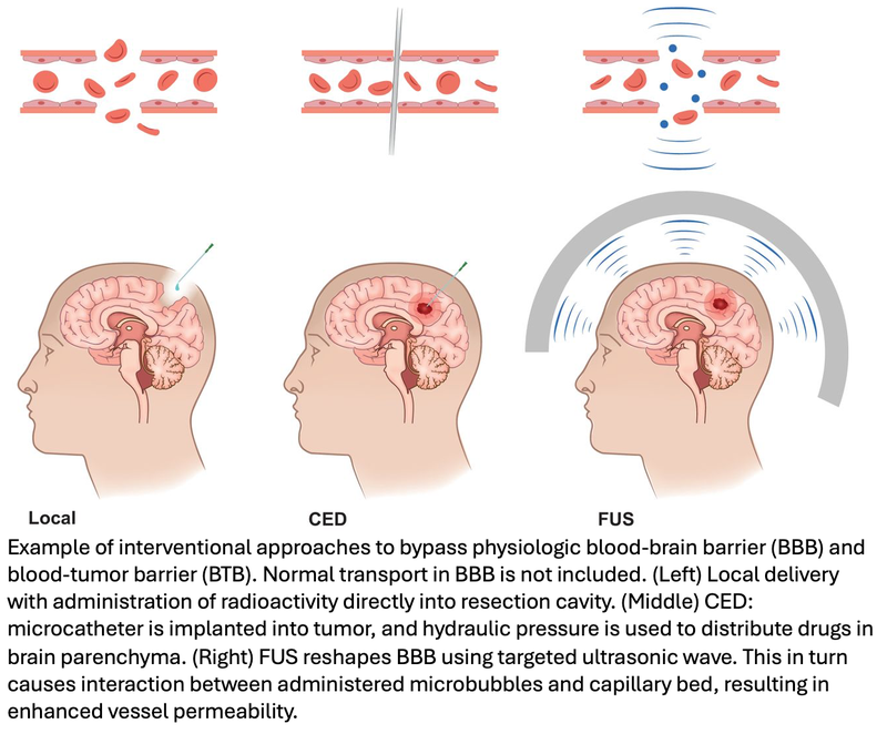 Future of Theranostics in Neurooncology Looks Promising With Recent Advancements
