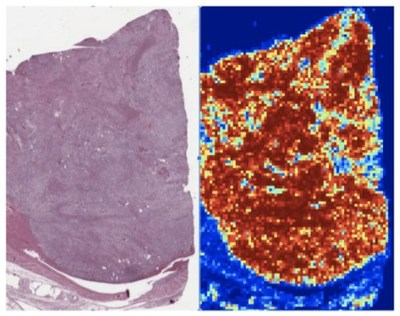 Using Explainable AI For Medical Image Processing and Cancer Screening
