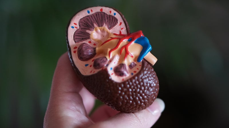 NCI Scientists Identify 50 New Genomic Regions Associated With Kidney Cancer Risk