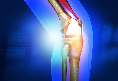 Minimally Invasive Procedure (GAE) Offers Relief for Knee Osteoarthritis Pain