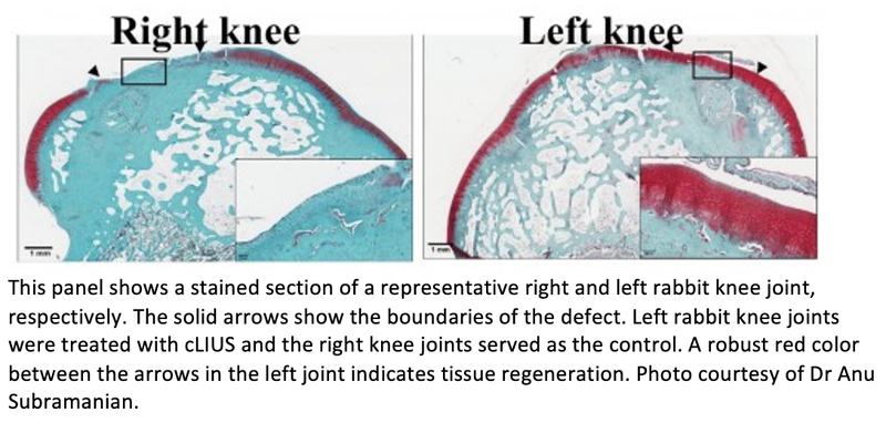 Low-Intensity Ultrasound Makes Knees Stronger After Injury or Surgery