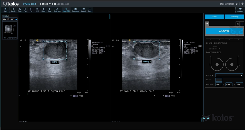 Koios Medical Smart Ultrasound AI Software Gets FDA Nod