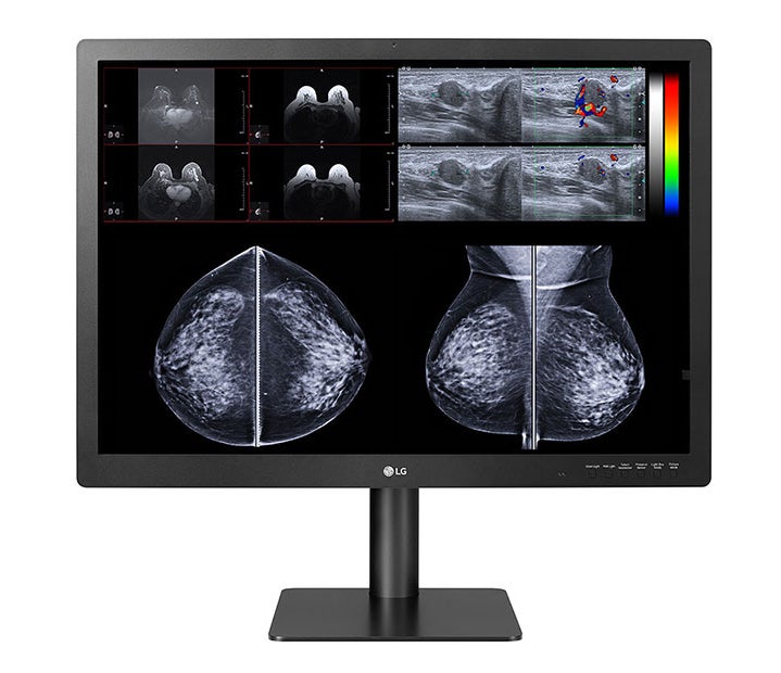 New 12MP Multi-modality Diagnostic Display