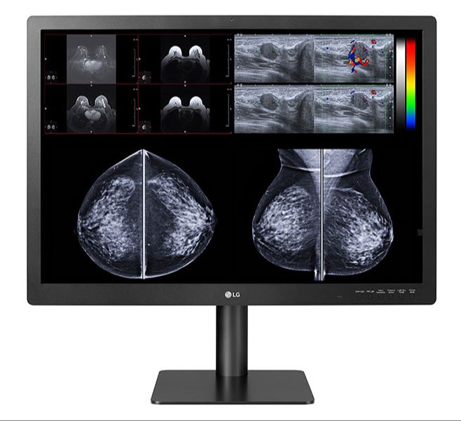 New 12MP Multi-modality Diagnostic Display