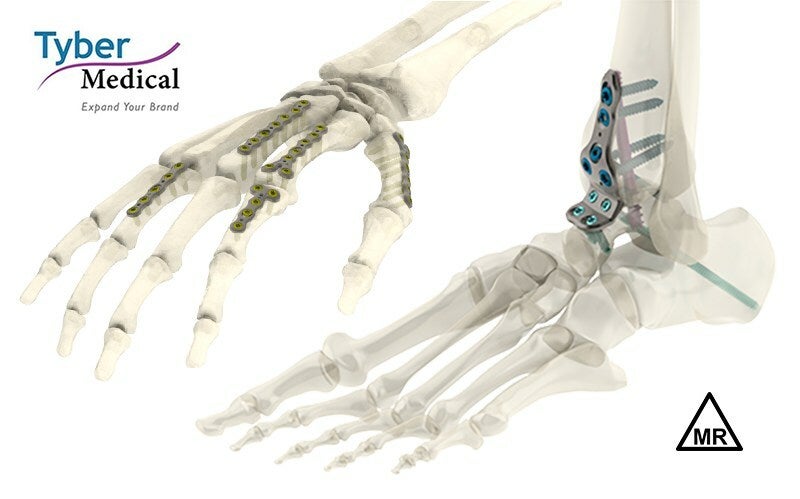 FDA Grants Additional MR Conditional Designation to Tyber Medical’s Anatomical Plate Portfolio