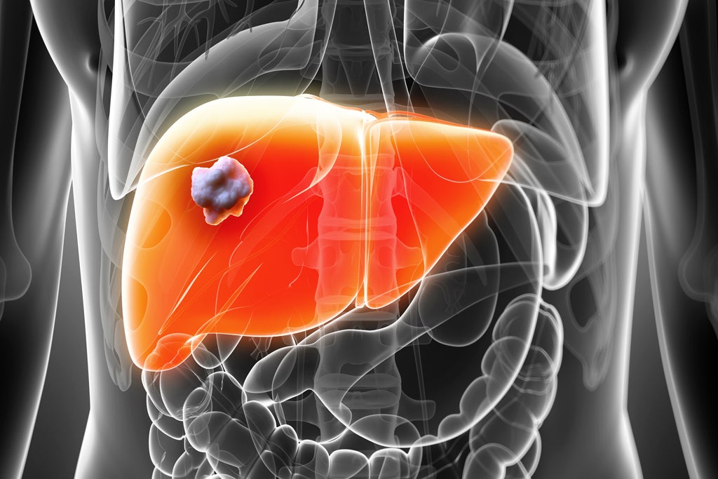 Tirzepatide Reduces Liver Fat Better than Insulin In Diabetic Patients