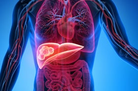 Immune-Boosting Effects of Histotripsy Extend to Cancer Cells Outside the Liver