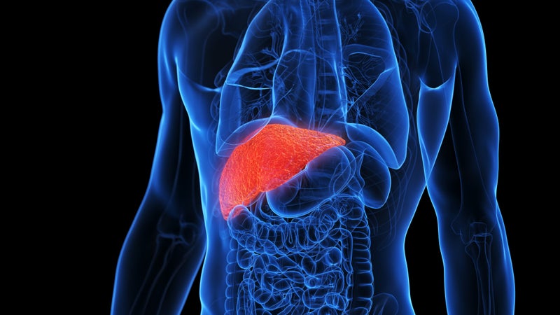 Transplant After Immunotherapy is Possible for Advanced Liver Cancer Patients