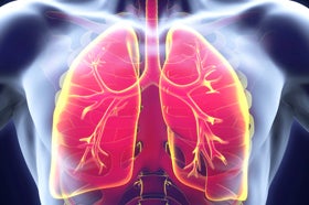 Immunotherapy Before and After Lung Cancer Surgery Reduces Recurrence, Death Risk