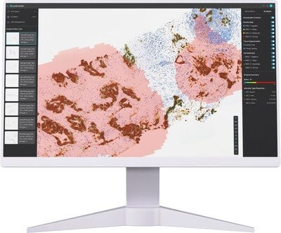 Lunit AI Enhances Precision in Predicting Outcomes for mCRC Patients Undergoing HER2-Targeted Therapy