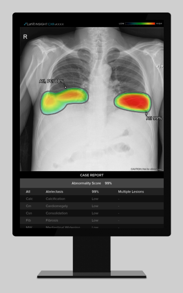 Lunit INSIGHT CXT Triage Gets FDA OK