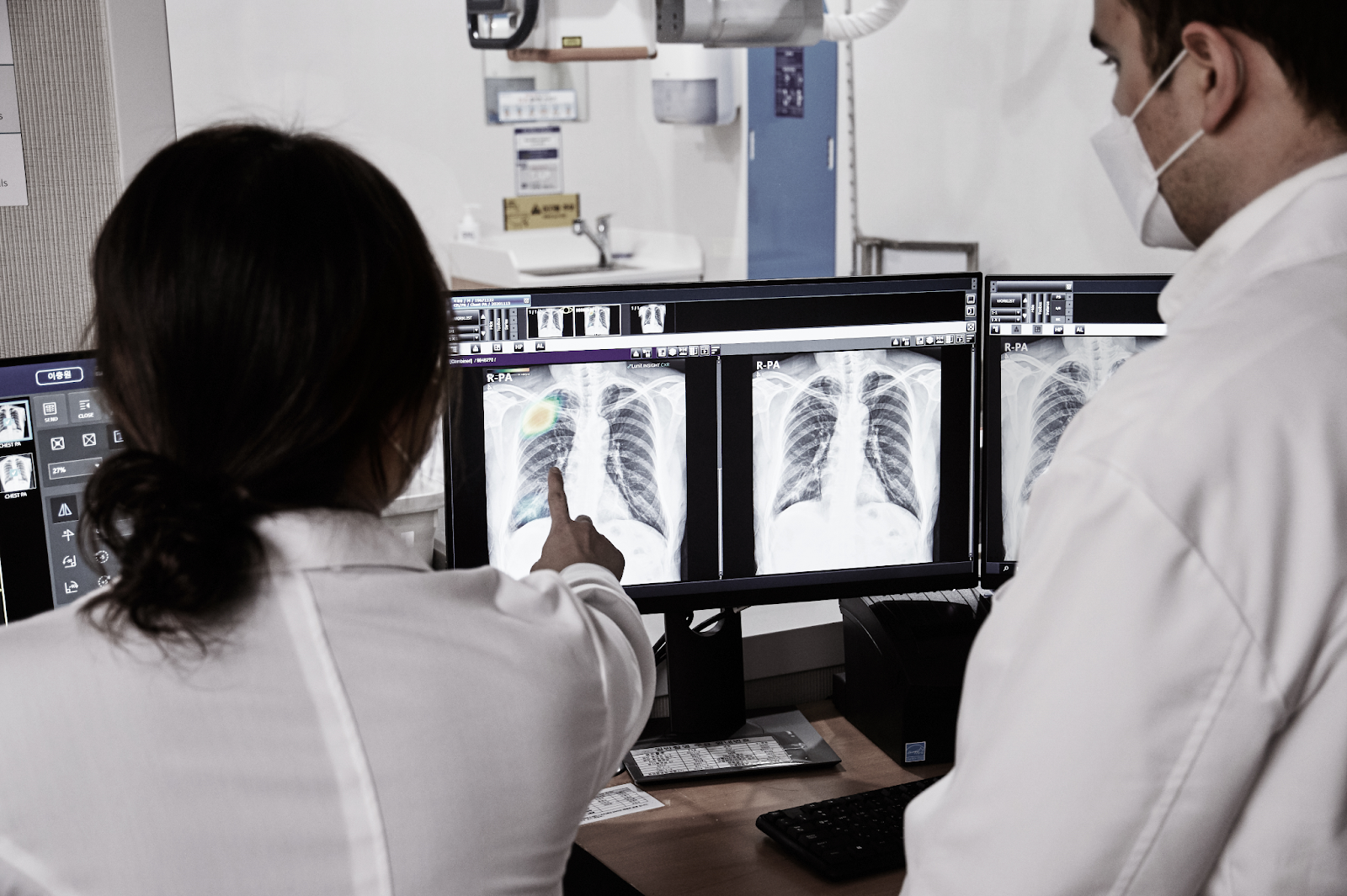 Unnecessary CT Exams Reduced by 30% When Analyzing Chest Radiographs with AI