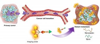 Tell-Tale Biomarker Detects Early Breast Cancer in NIH-Funded Study