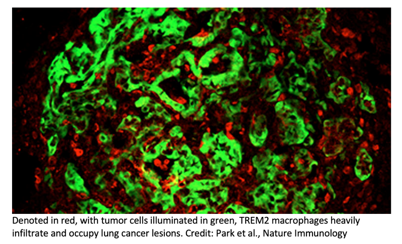 New Immuno-Oncology Approach for Most Common Lung Cancer Identified