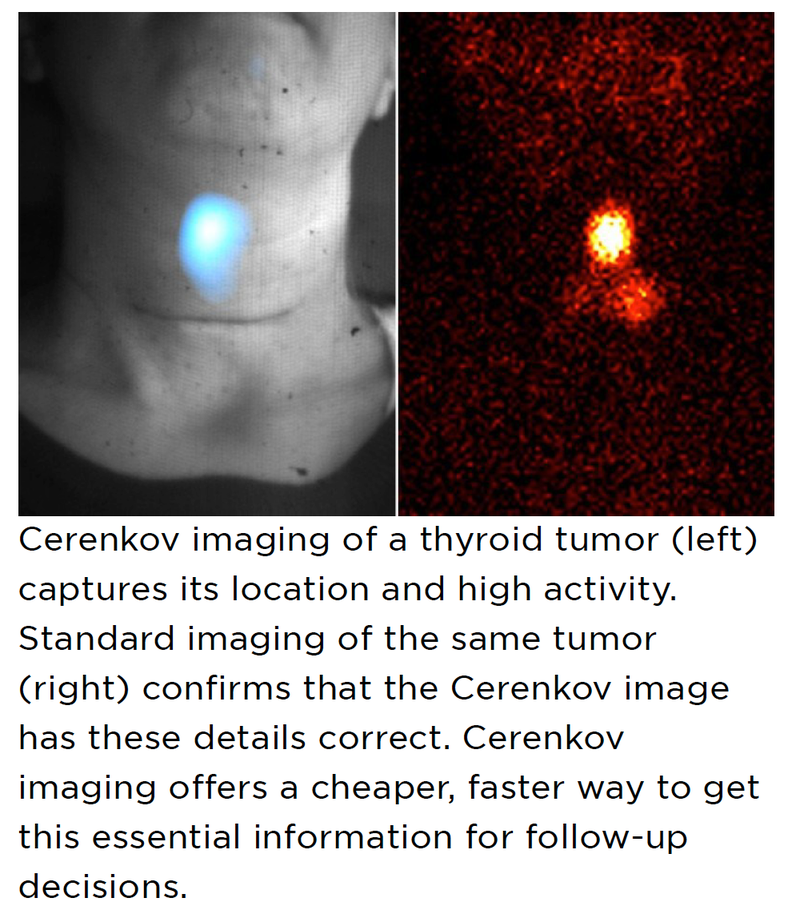 Imaging Technique May Improve Cancer Screening and Diagnosis in Rural Areas, Developing Countries