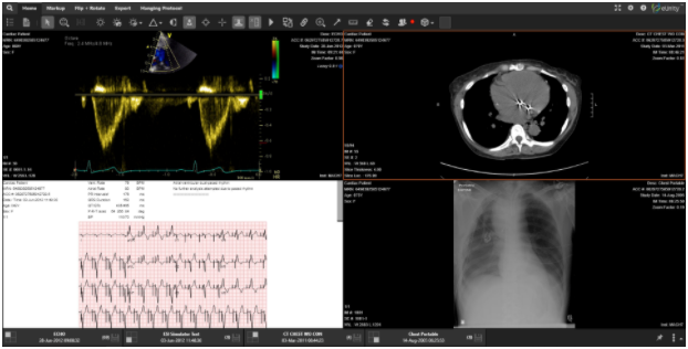 Mach7, ImageMover Partner to Add Point-of-Care Images and Videos to Enterprise Imaging Solution