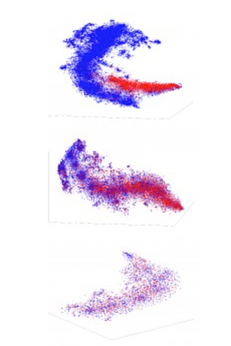 Machine Learning Model Reduces Uncertainty in Breast Cancer Diagnosis
