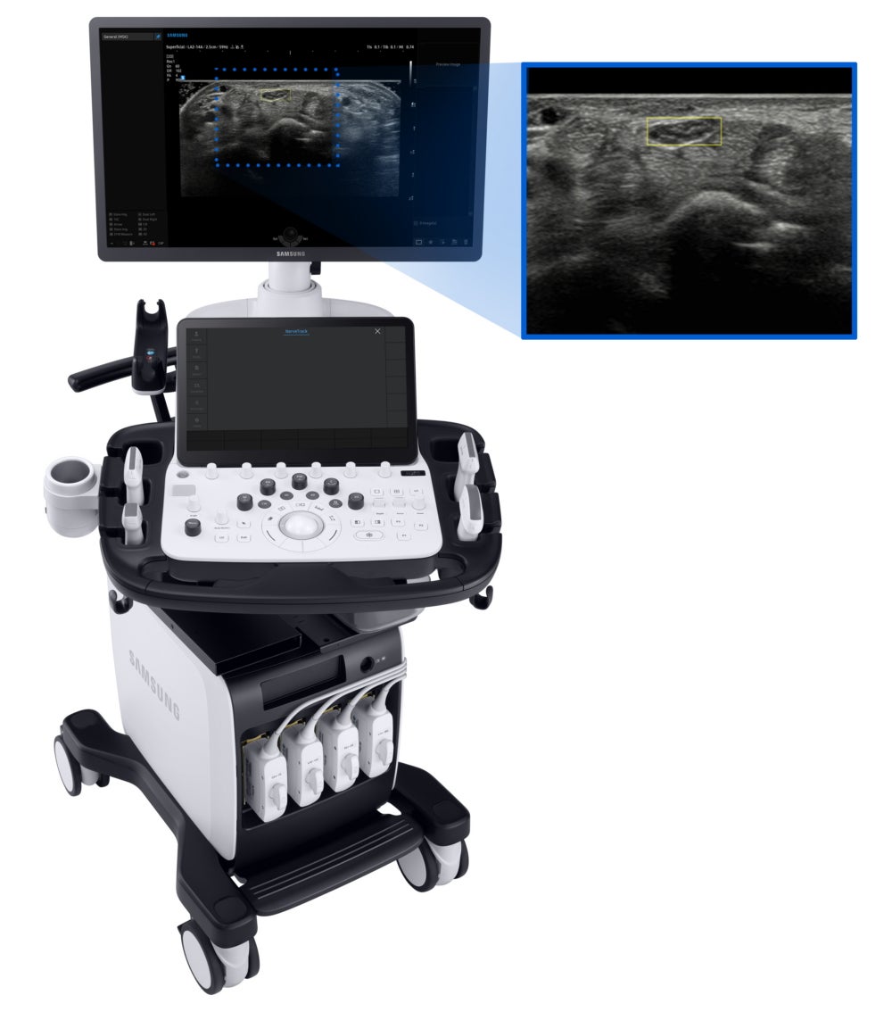 Samsung Introduces New Ultrasound System
