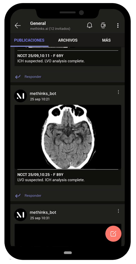 AI-Based Stroke Triage Software Receives CE Mark
