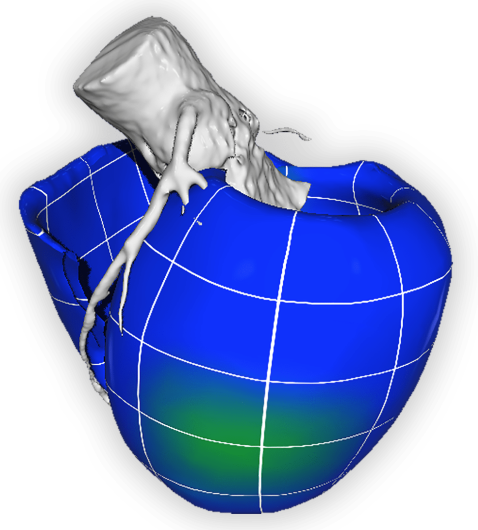 Stress Testing Protocol with Hyperventilation/Breath-hold Accurately Detects Myocardial Ischemia
