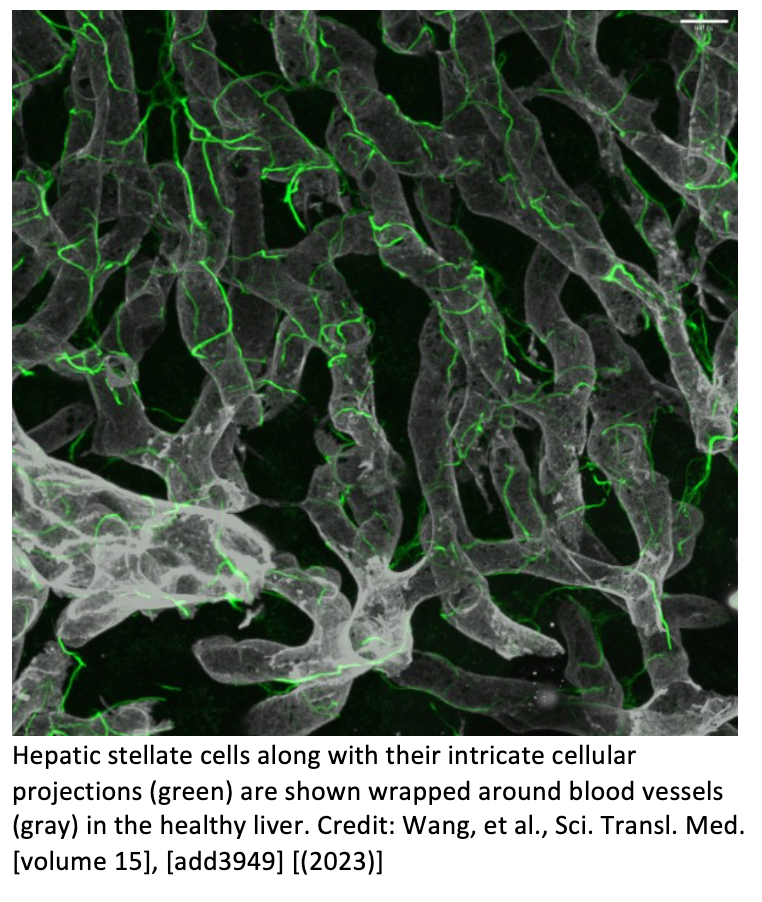 Potential New Targets Found for Treating Fatty Liver Disease