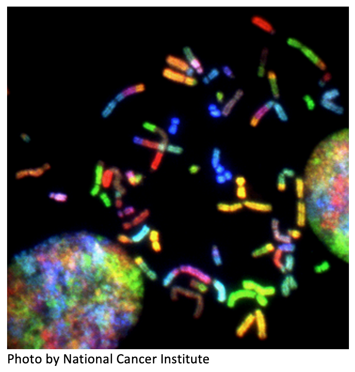 NCI $10M Grant to Montefiore Einstein Cancer Center to Study Lung Metastasis in Breast Cancer