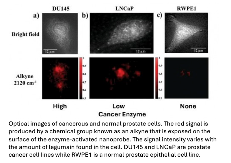 Smart Nanoprobe Sends Signal to Illuminate Prostate Cancer Cells